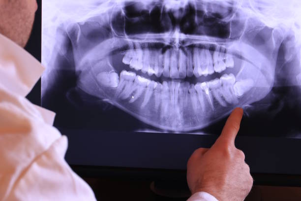 Best Urgent Care for Lost Fillings or Crowns in Arbutus, MD